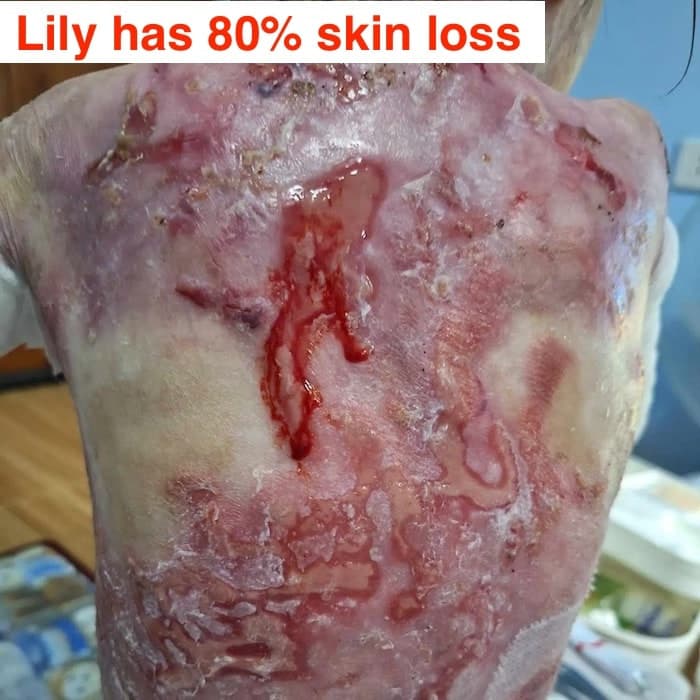 Help Lily