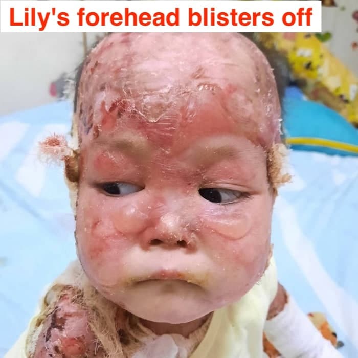 Help Lily