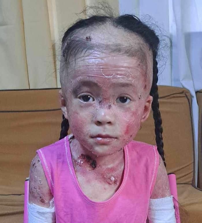 Help for Nathania