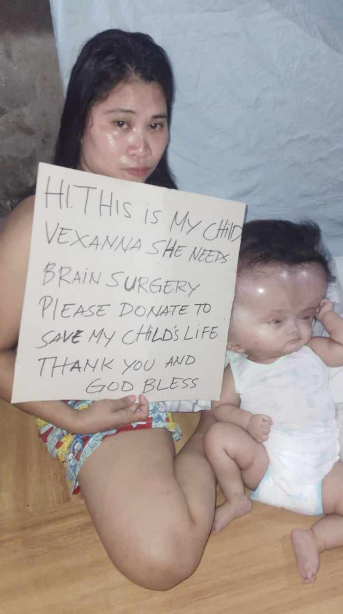 Help Vexanna