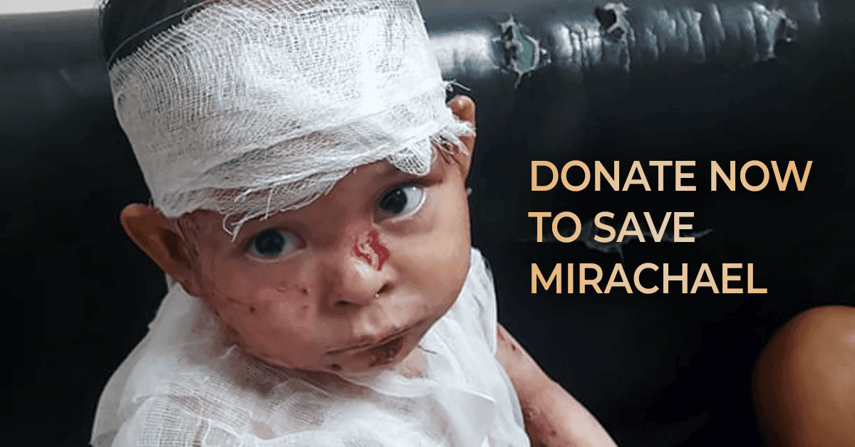 Help Mirachael