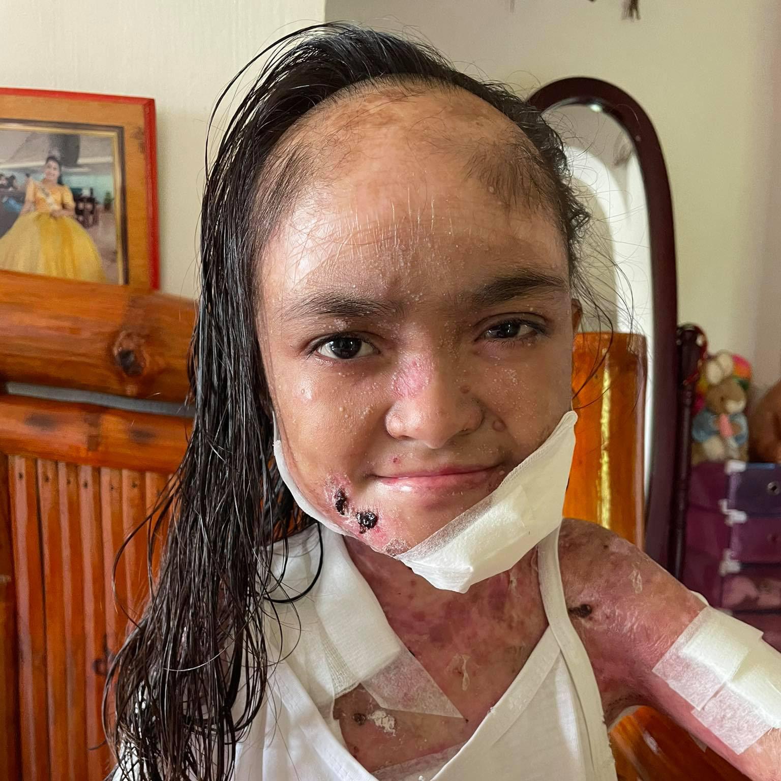 Joyce lives with pain no child should have to endure