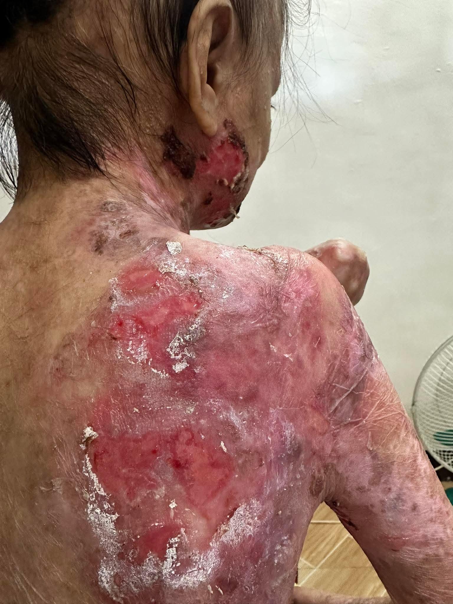 Joyce lives with pain no child should have to endure