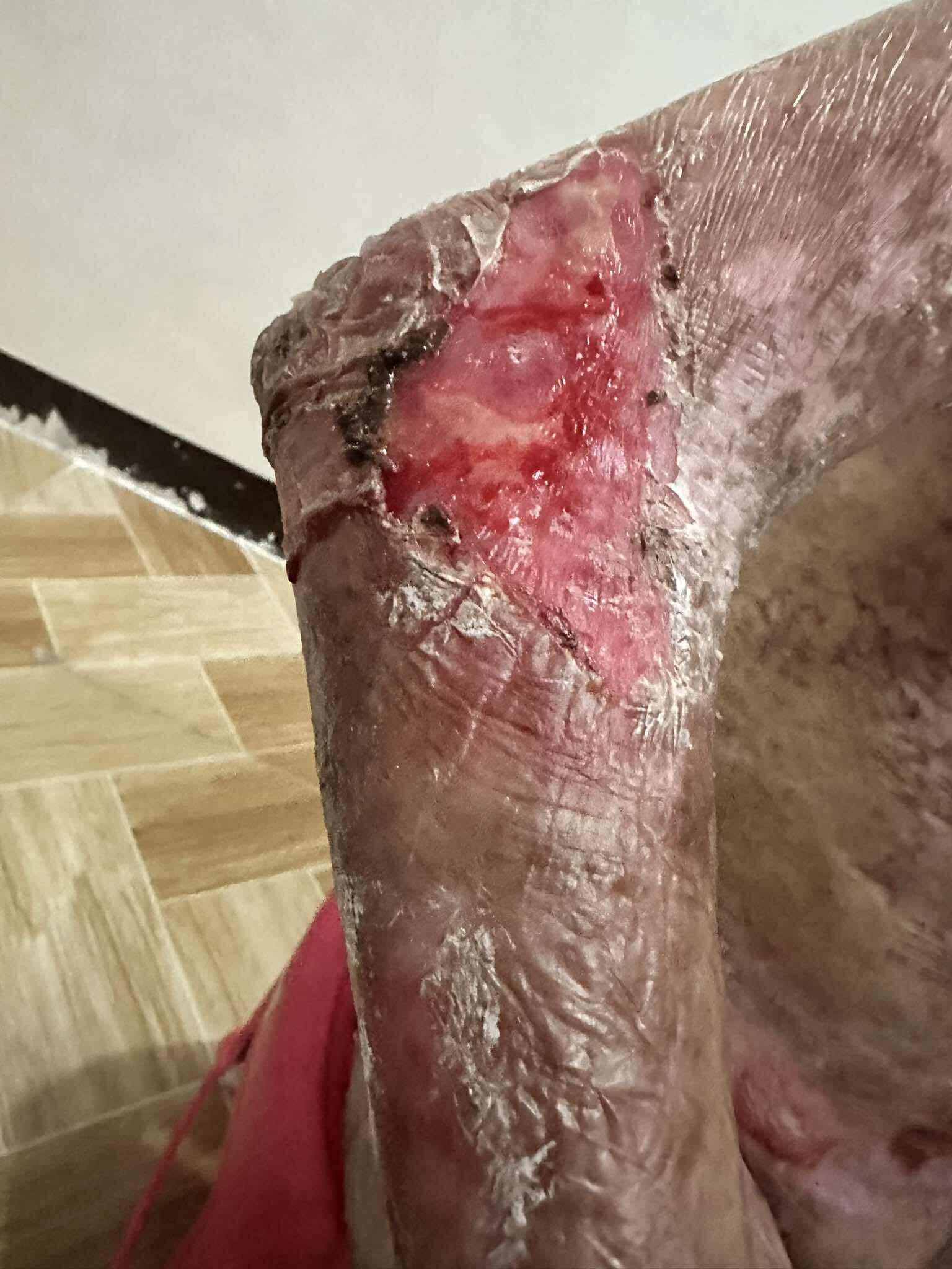 Joyce lives with pain no child should have to endure