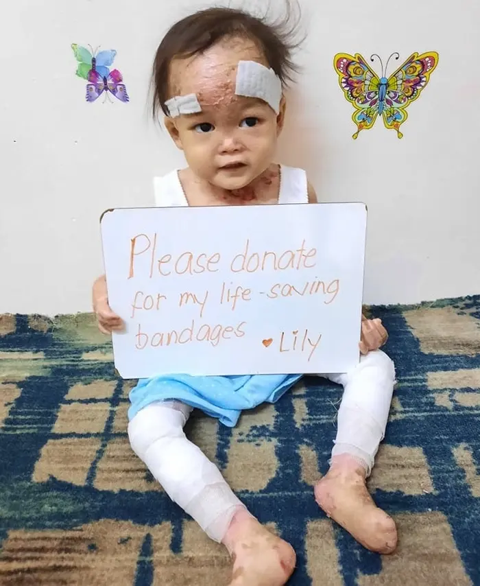 Lily lives with pain no child should have to endure