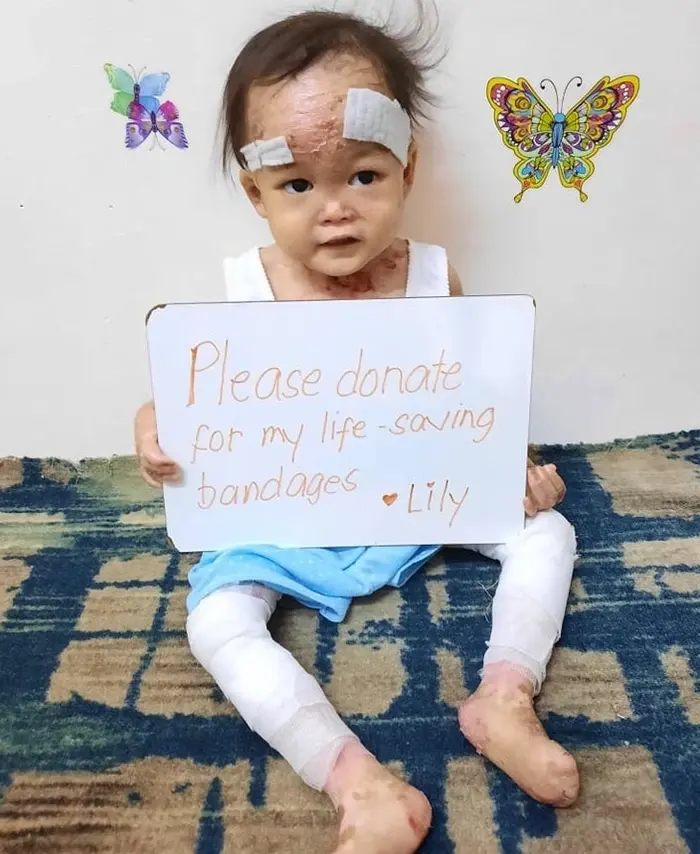 Lily lives with pain no child should have to endure