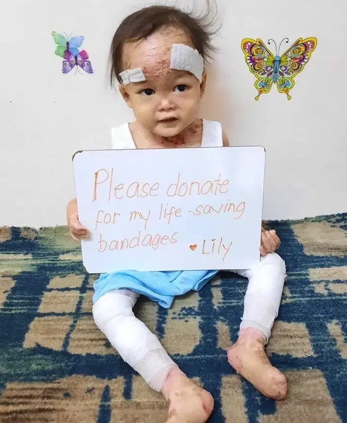 Lily lives with pain no child should have to endure