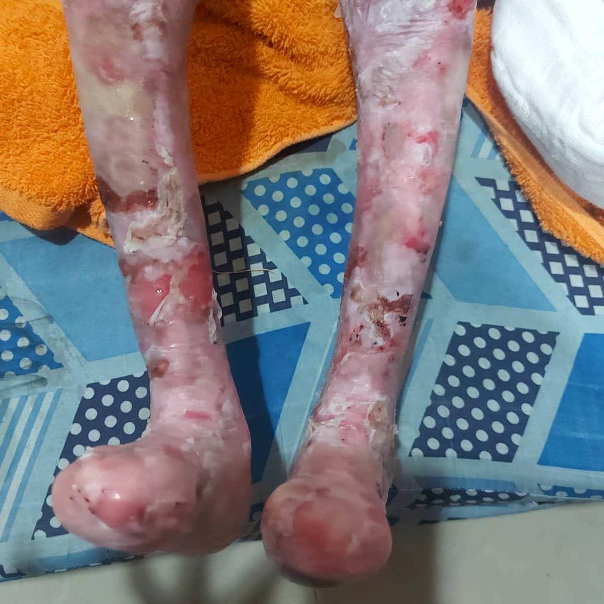 Mirachael lives with pain no child should have to endure