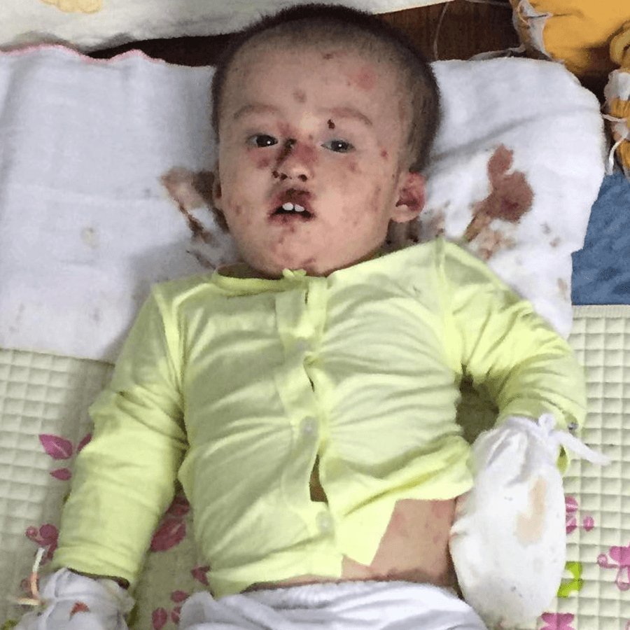 John lives with pain no child should have to endure