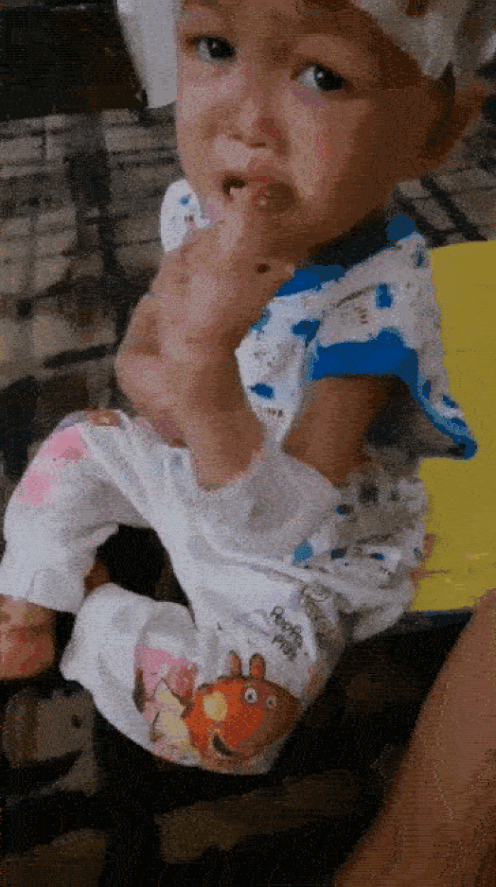 Lily lives with pain no child should have to endure